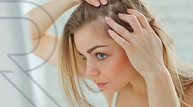 Queda de Cabelo Feminina Imagem Queda de Cabelo Feminina